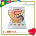 Stomach Disease Model (PH6060)